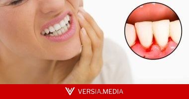 حلوى مطاطية ببكتيريا نافعة تقلل نزيف اللثة خلال 6 أسابيع.. دراسة توضح
