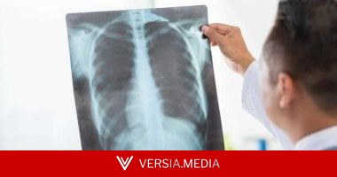 الالتهاب الرئوى.. علامات تحذيرية مبكرة قد تنقذ حياتك من عدوى خطيرة
