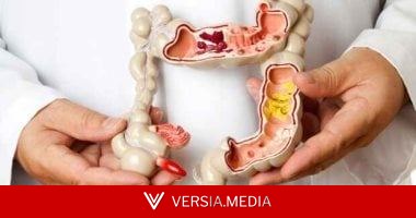 تناول اللحوم الحمراء يزيد من حدة أعراض هذا المرض المعوى
